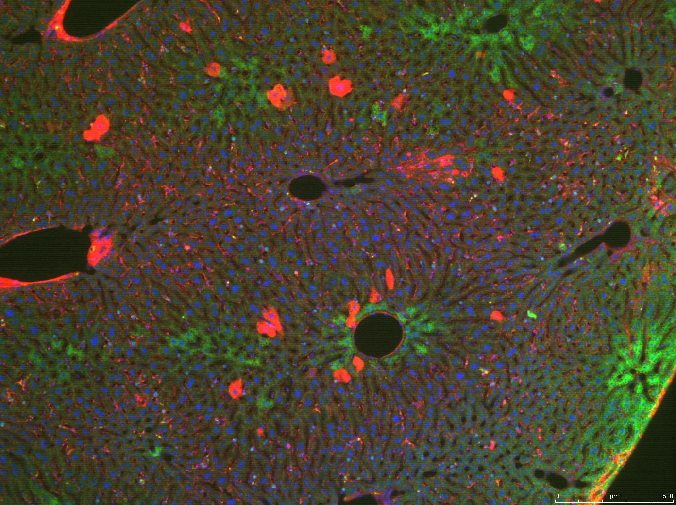Mittels indirekter Immunfluoreszenz angefärbtes Leberpräparat