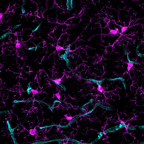 microglia