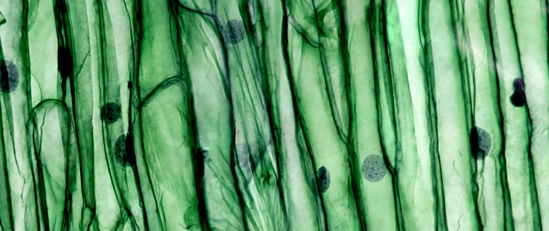 Microscopic magnification of plant cells