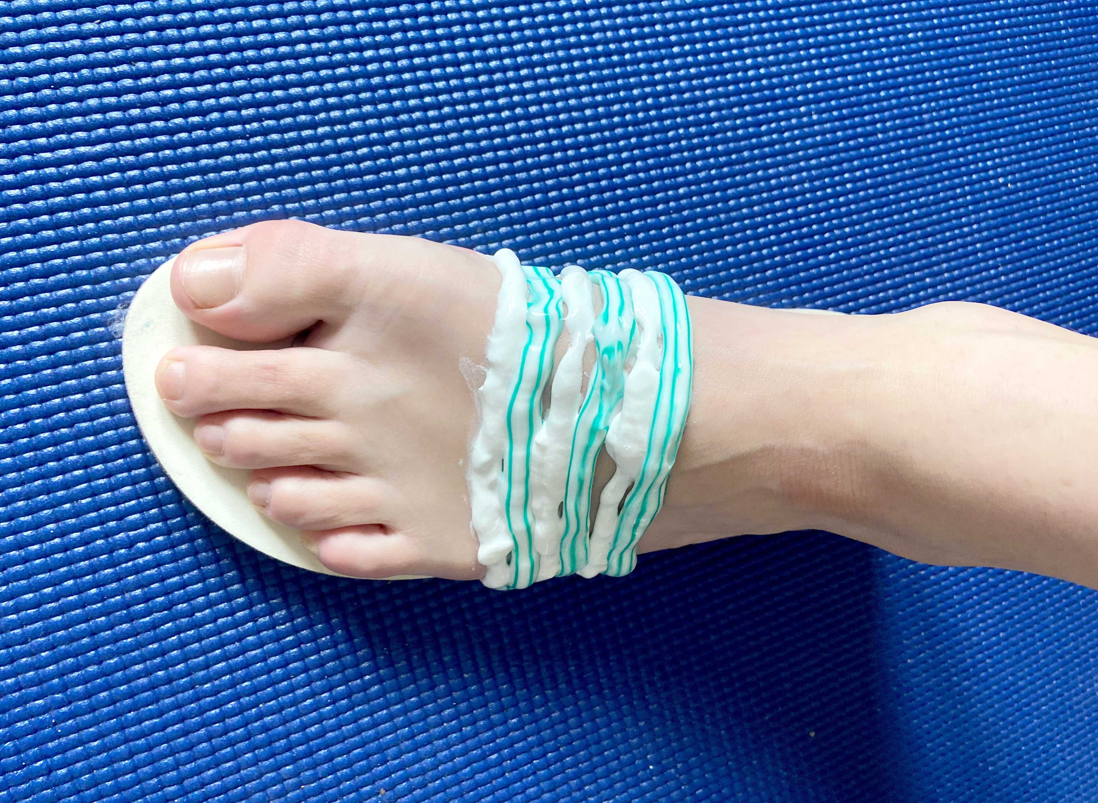 Menschlicher Fuß auf einer Schuheinlage vor blauem Hintergrund. Auf dem Fuß sind Zahnpastastreifen